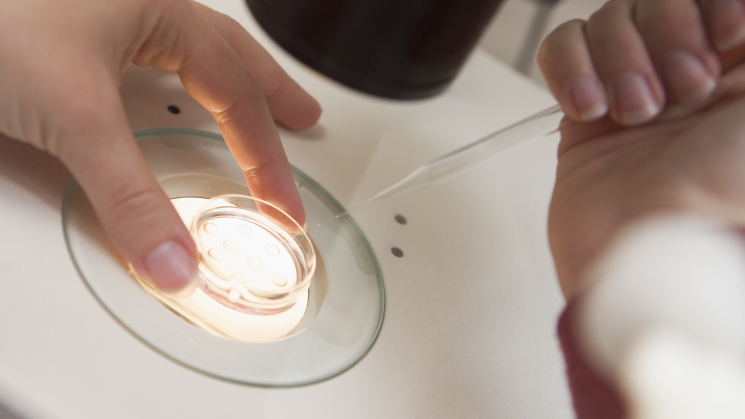 IVF Frequently Asked Questions
