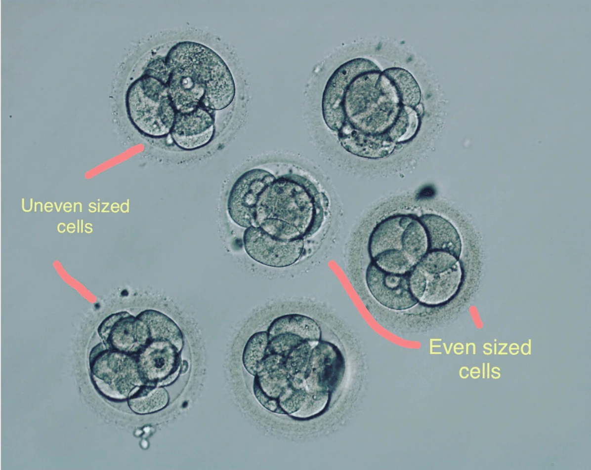 Cleavage stage grading. What do we look for? - Spring Fertility